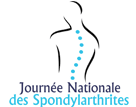 Spondylarthrite ankylosante, les infos