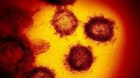 Coronavirus – Infos 21.03.2020